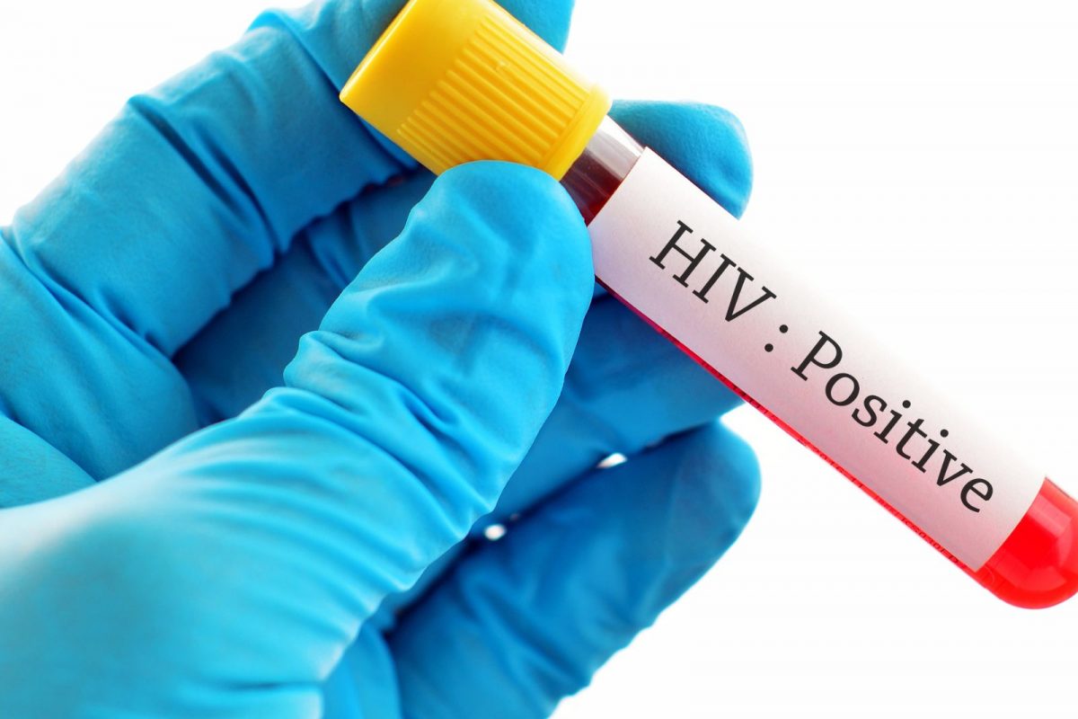hiv positive 16697912413x2 Yw0fVd