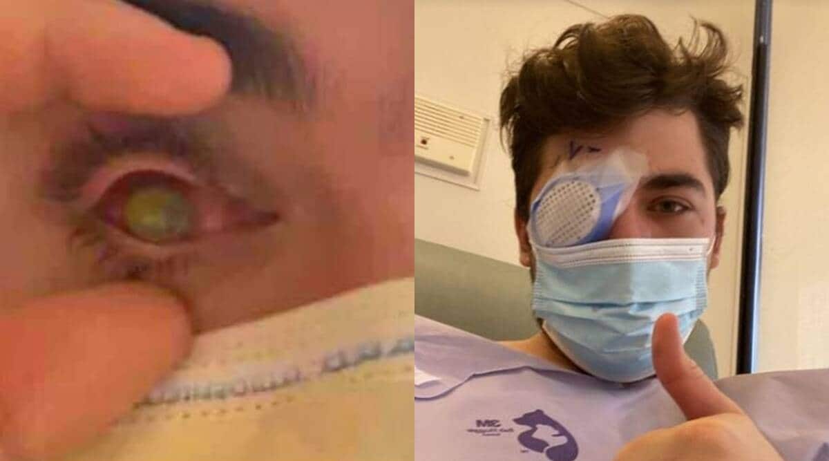 contact lens infection florida man 1200 UnUfuR