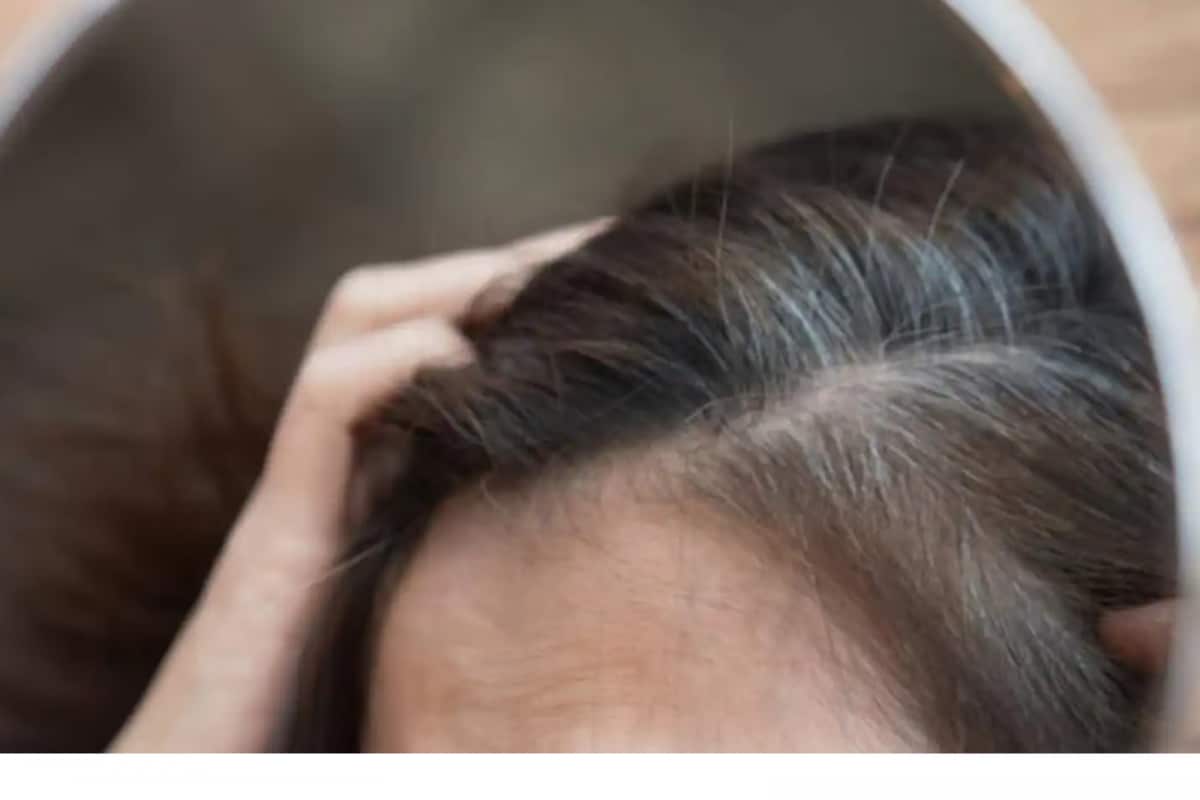want to get rid of grey hair 16752509883x2 CJAYo5